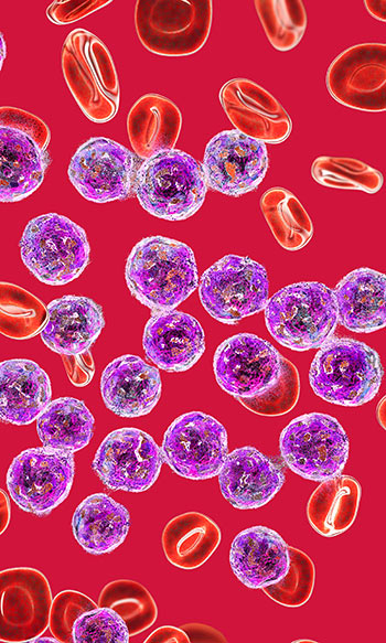 AML Cells